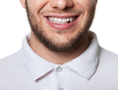 What Happens If You Don’t Replace A Missing Tooth?