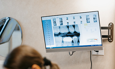Monitor displays dental X-ray used by dentist to assess patient’s teeth and treatment needs.