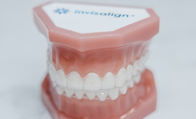 Teeth With Invisalign Example